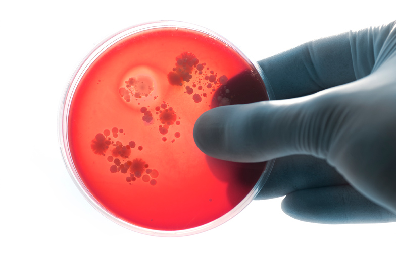 Petrischale mit Nährstoffträger für Analyse Schimmelpilzbefall